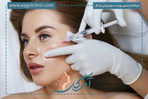 اندولیفت ابرو چیست؟ لیفت ابرو بدون جراحی با اندولیفت + مزایا