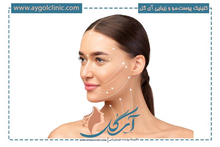 انواع عوارض اندولیفت و روشهای مدیریت آنها