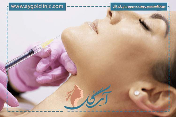 فواید بوتاکس چانه در زیبایی و فرم صورت شامل رفع چین‌وچروک و افزایش تقارن است.