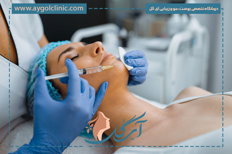 تاثیر بوتاکس چانه در رفع چانه پرتقالی یا دیمپل‌دار به ایجاد سطحی صاف و جذاب کمک می‌کند.