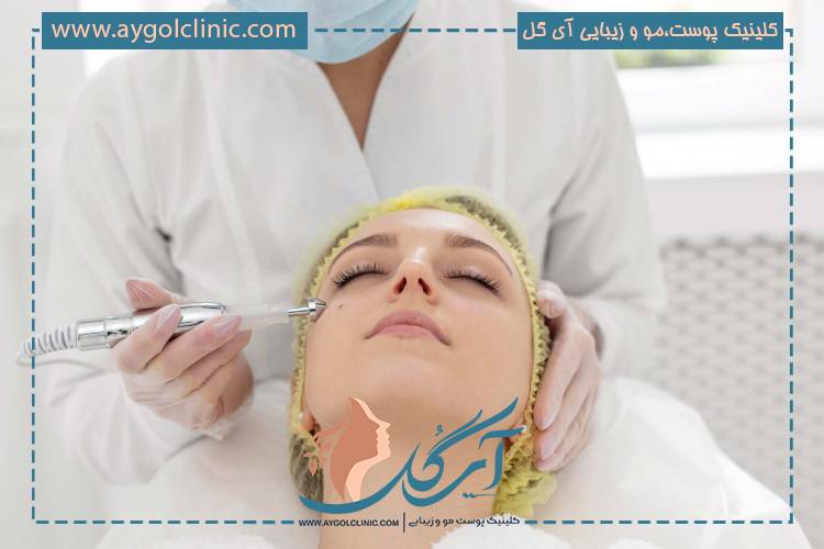 مقایسه اندولیفت و هایفو در جوانسازی پوست