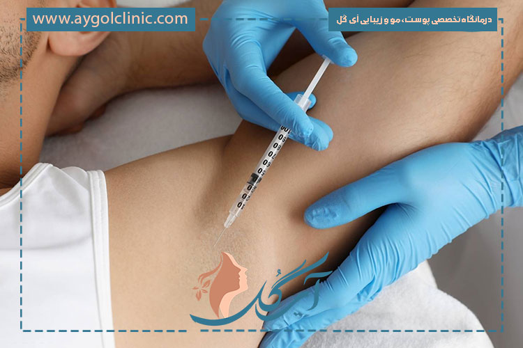 کاربرد بوتاکس در درمان اسپاسمهای عضلانی باعث کاهش درد و بهبود حرکت میشود.