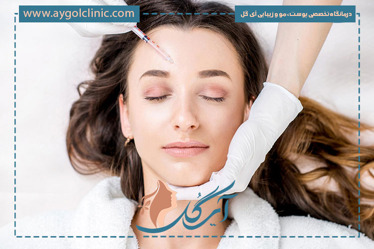 ترمیم بوتاکس مهمترین عامل در حفظ نتیجه بوتاکس