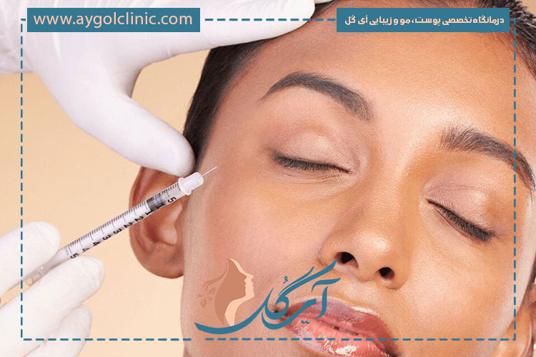 بهترین بوتاکس صورت با انتخاب مواد باکیفیت و تزریق مناسب