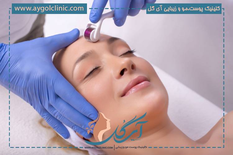 مراقبتهای بعد از سابسیژن برای پوست صاف و سالم
