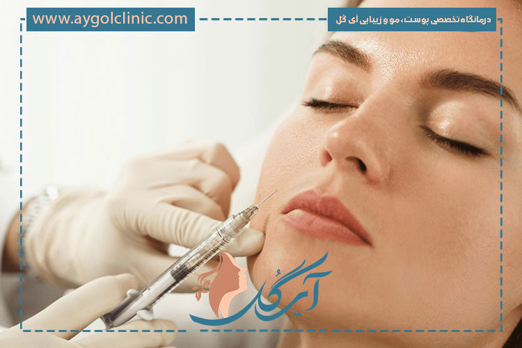 آبرسانی و بهبود کیفیت پوست با فیلر آلیاکسین