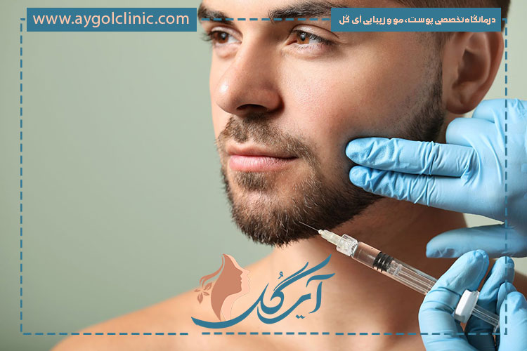 لیفتینگ ماندگار نقاط مختلف صورت با فیلر آلیاکسین