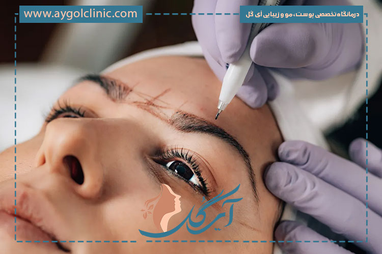 بهترین روش‌های کاشت ابروی طبیعی و زیبا