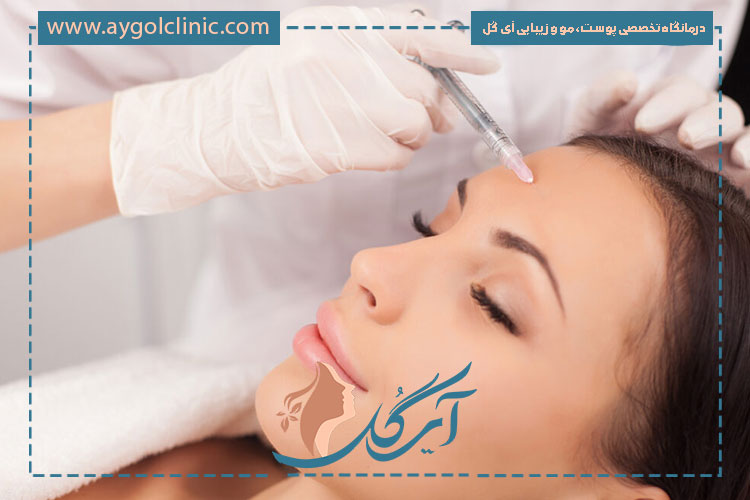 ماندگاری بوتاکس پیشانی با رعایت نکات مراقبتی