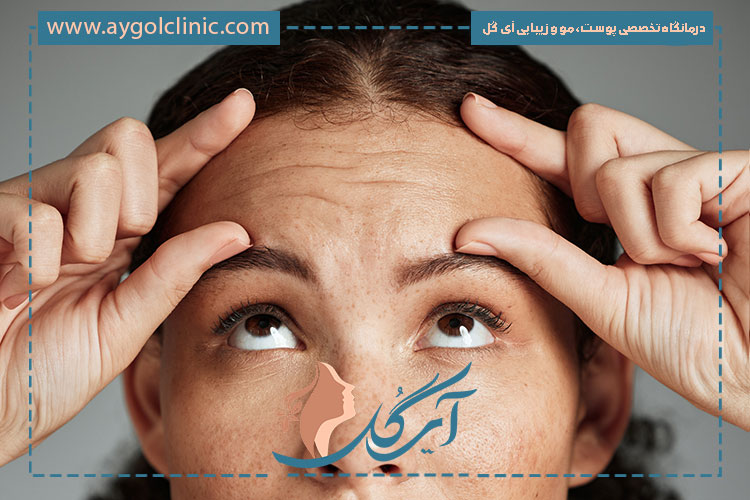 تاثیر پزشک و کلینیک در ماندگاری بوتاکس پیشانی