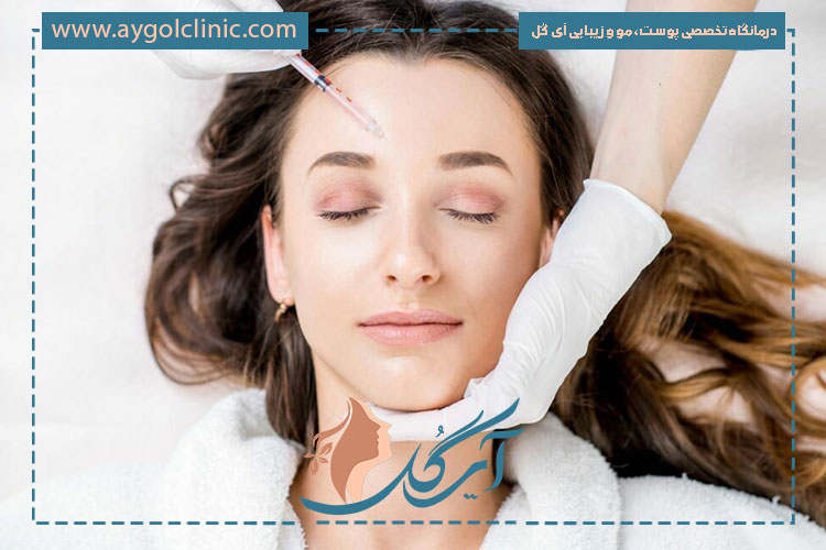 عوامل موثر در ماندگاری بوتاکس پیشانی