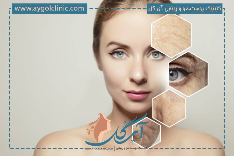 روشهای درمانی کلینیکی مانند اندولیفت و مزوتراپی