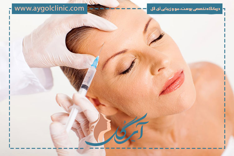 نتیجه مثبت از تزریق بوتاکس پیشانی با رعایت مراقبتهای اصولی