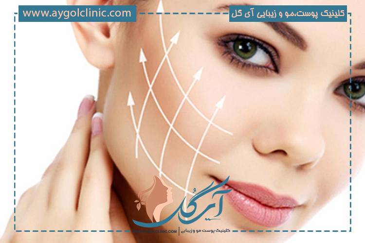 عوارض اندولیفت و نکات مهم قبل از انجام