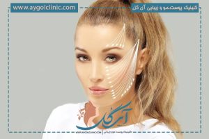اندولیفت برای چه سنی مناسب است؟ مزایا، عوارض و مراقبت‌ها