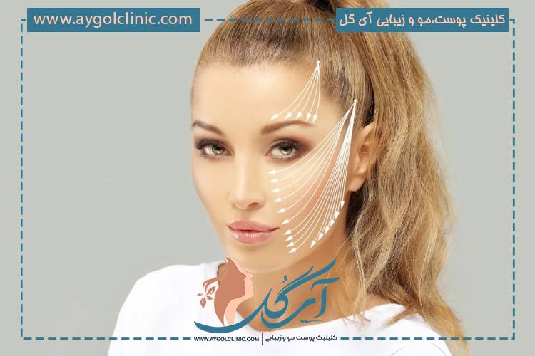 اندولیفت برای چه سنی مناسب است و کاربردهای آن