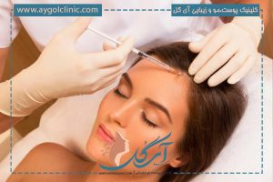 هیر فیلر چیست و چگونه می‌تواند ریزش مو را کاهش دهد؟