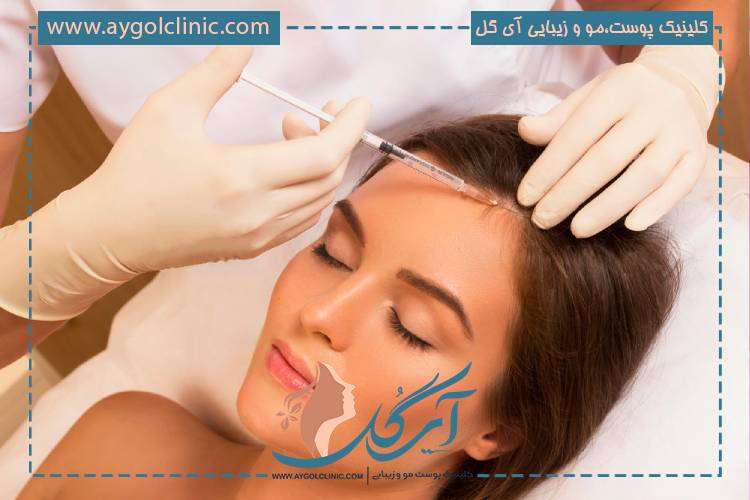 هیر فیلر چیست و چگونه موها را تقویت میکند