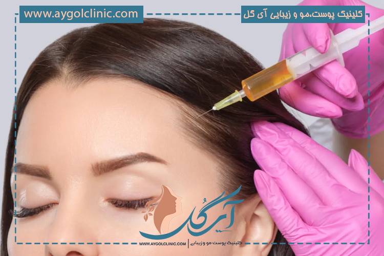 بهترین برند و تاثیر هیر فیلر بر رشد و ضخامت مو