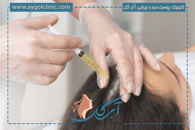 روش تزریق و مراقبت بعد از هیر فیلر در کلینیک