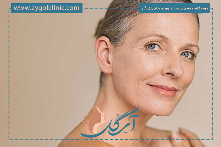 عوارض اندولیفت پیشانی معمولاً خفیف بوده و شامل تورم یا قرمزی موقتی می‌شود