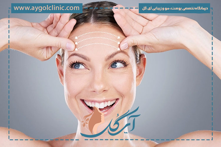 مزایای اندولیفت پیشانی شامل جوانسازی پوست، کاهش چروک و سفتی طبیعی پوست است