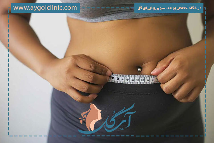 اندولیفت شکم روشی ایمن و کم‌درد است که با بی‌حسی موضعی انجام می‌شود.