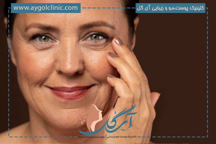تفاوت بین عوارض طبیعی و عوارض خطرناک در لیزر CO2 به شدت و ماندگاری علائم بستگی دارد.