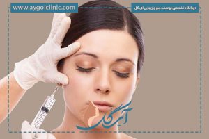 لیفت شقیقه با بوتاکس؛ کاربردها، مراحل، ماندگاری و نکات مهم