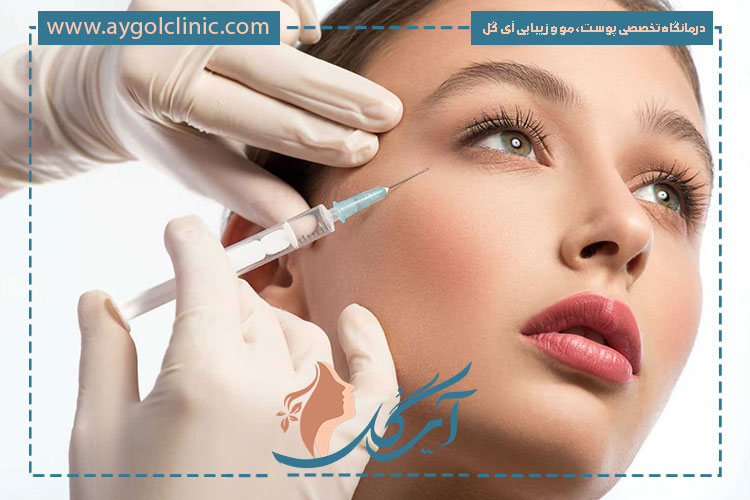 مزایای بوتاکس مصپورت در رفع خطوط صورت و ایجاد ظاهری شاداب و طبیعیتر