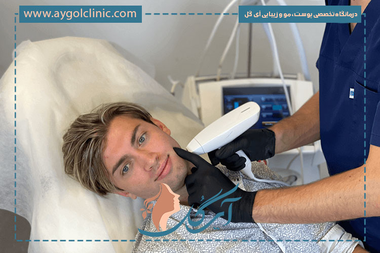 مزایای آر اف فرکشنال باعث جوانسازی پوستی، سفتی بیشتر و بهبود بافت می‌شود