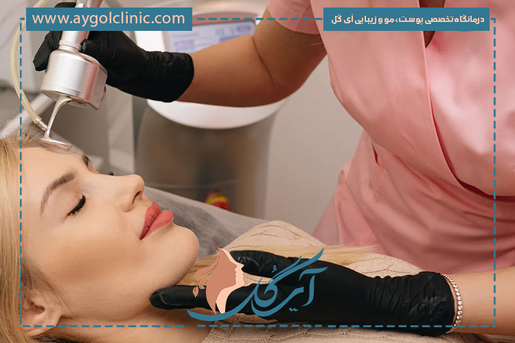 آیا نتایج لیزر فرکشنال دایمی است؟ بررسی ماندگاری درمان در طولانی‌مدت