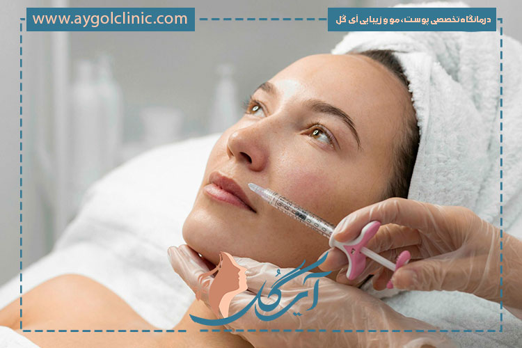 مزایای فیلر زیشل شامل فرم‌دهی طبیعی، قیمت مناسب و سازگاری بالا با پوست