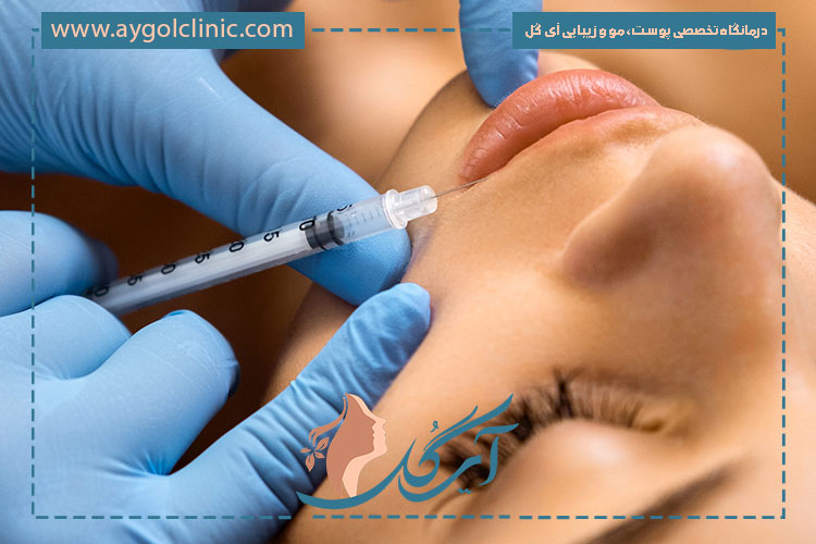 آشنایی با مزایای فیلر رووفیل شامل ایمنی بالا، فرم‌دهی دقیق و رضایت مراجع