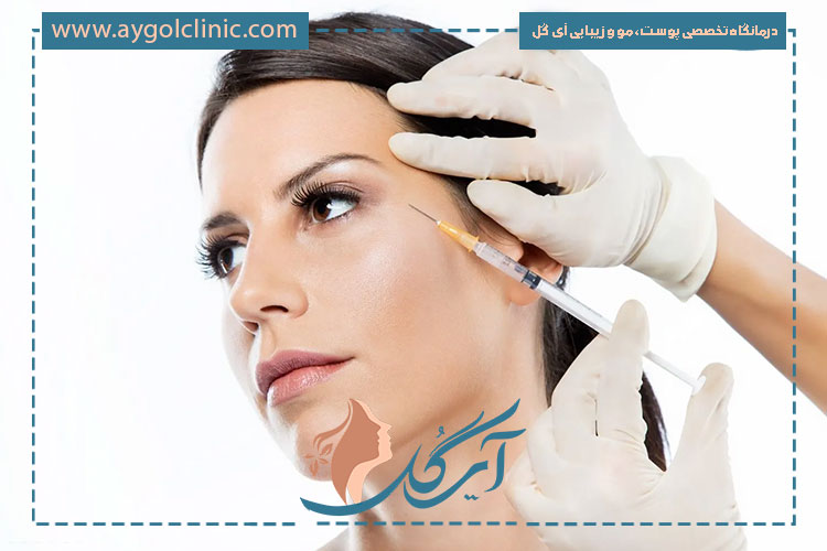 نواحی قابل تزریق در فیلر فول فیس برای حجم‌دهی هماهنگ و اصلاح فرم صورت