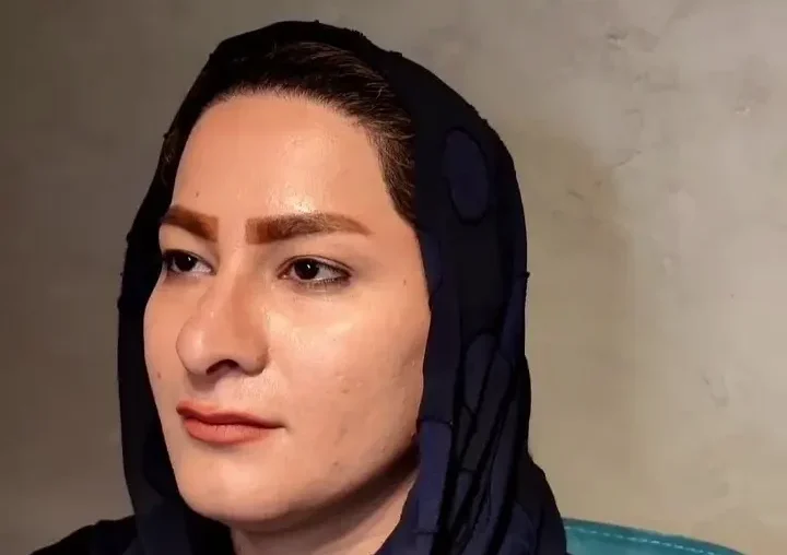 بلفاروپلاستی