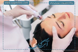 تزریق بایوفیلر؛ راهکار نوین جوانسازی و حجم‌دهی طبیعی پوست