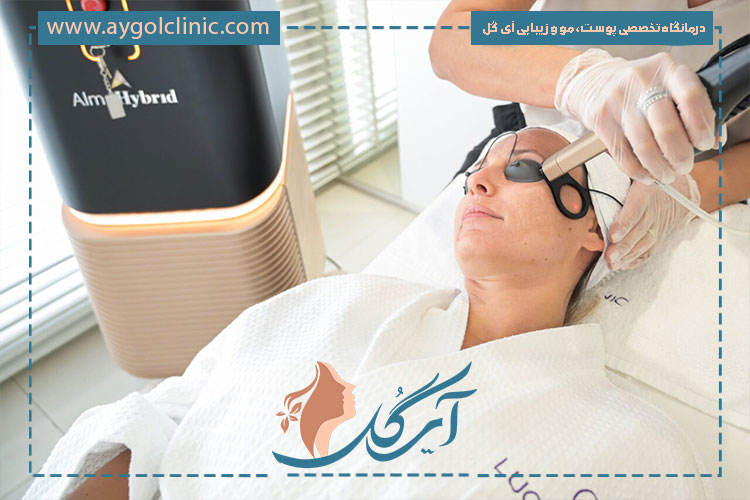 بررسی مهم‌ترین مزایای دستگاه لیزر فرکشنال در جوانسازی و بهبود بافت پوست