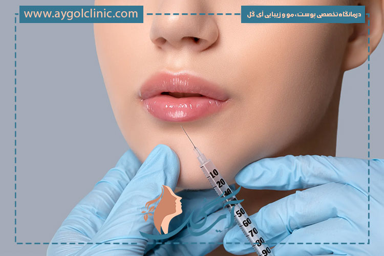 فواید ژل رستیلن شامل افزایش حجم طبیعی، آبرسانی عمیق و بهبود فرم صورت