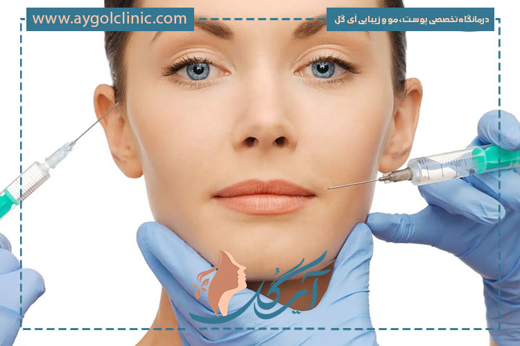 ماندگاری ژل ژوویدرم بسته به نوع تزریق، ناحیه درمان و متابولیسم بدن متفاوت است