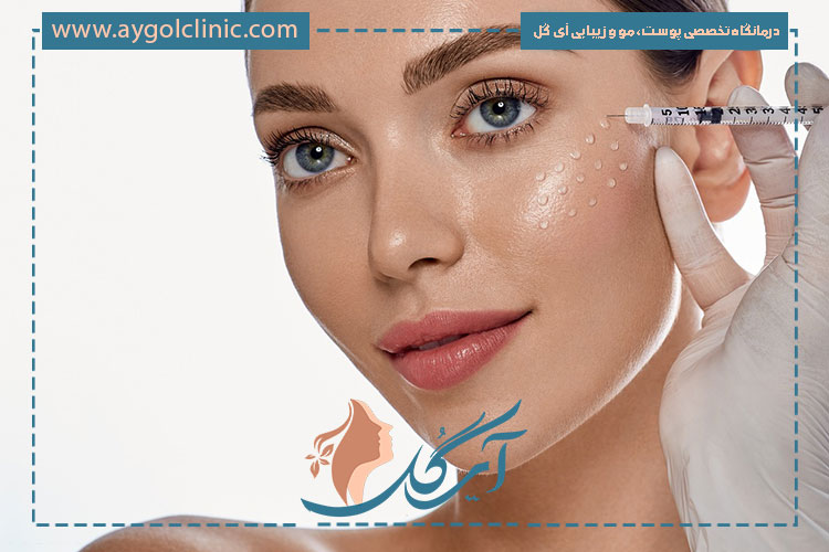 فیلر لب و صورت برای حجمدهی و فرمدهی طبیعی و ماندگار