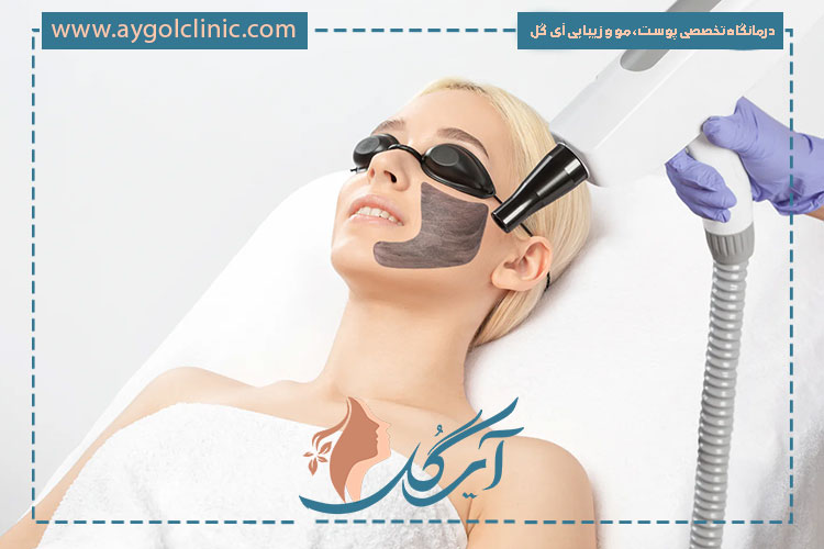 بررسی عوارض لیزر کربن و مراقبت‌های بعد از آن برای حفظ سلامت پوست