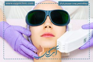 لیزر فرکشنال برای منافذ باز پوست؛ مزایا، مراحل و ماندگاری