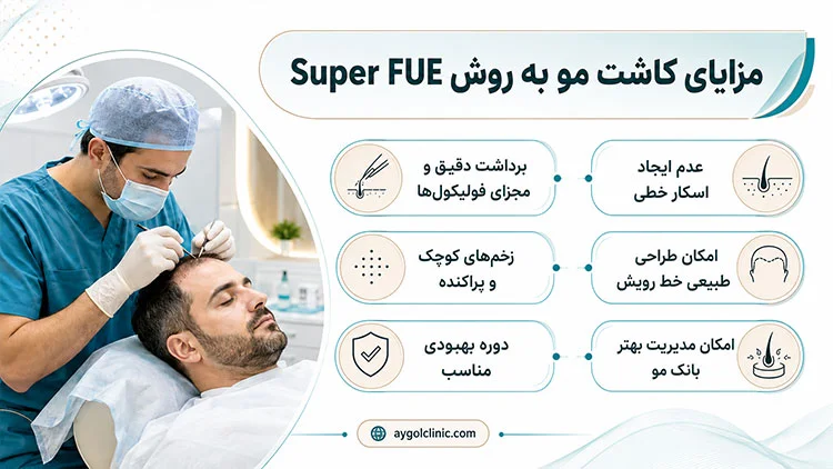 مزایای مهم کاشت مو به روش سوپر FUE 