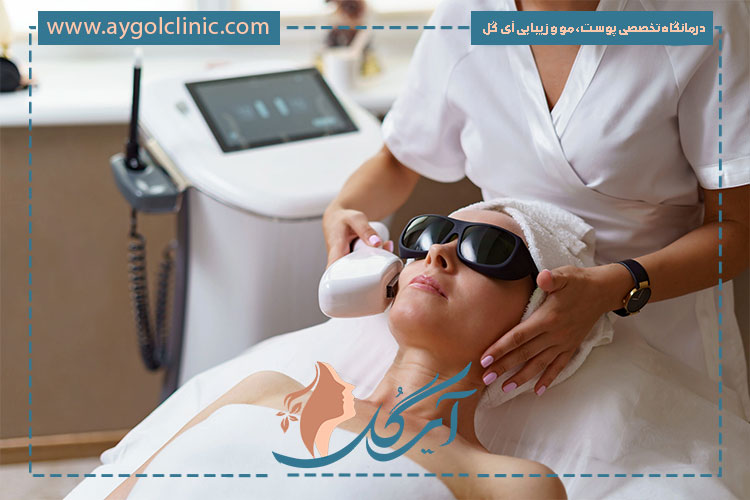 لیزر کربن برای چه نوع پوستی مناسب نیست و چه افرادی باید از آن پرهیز کنند