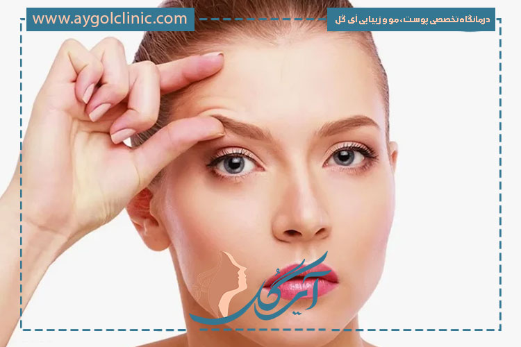 مراقبت های بعد از لیفت شقیقه برای کاهش تورم و بهبود سریع‌تر