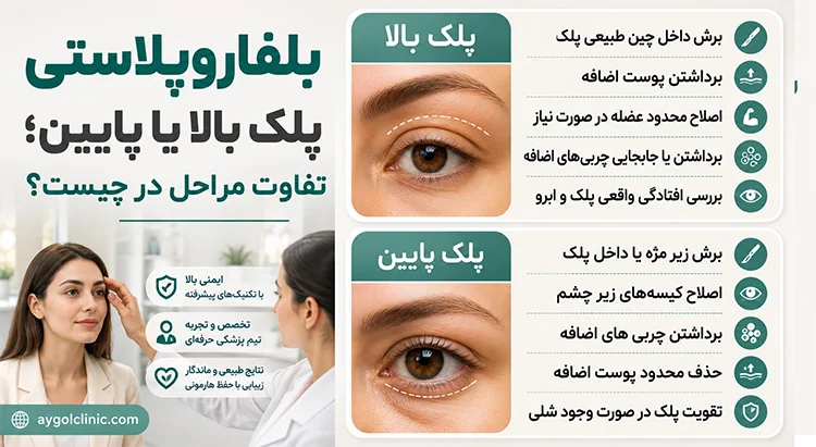 مراحل عمل بلفاروپلاستی پلک بالا و پایین 