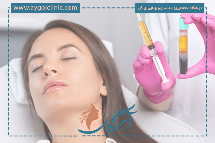 عوارض تزریق بایوفیلرها شامل تورم موقت، کبودی خفیف و واکنش‌های گذرا