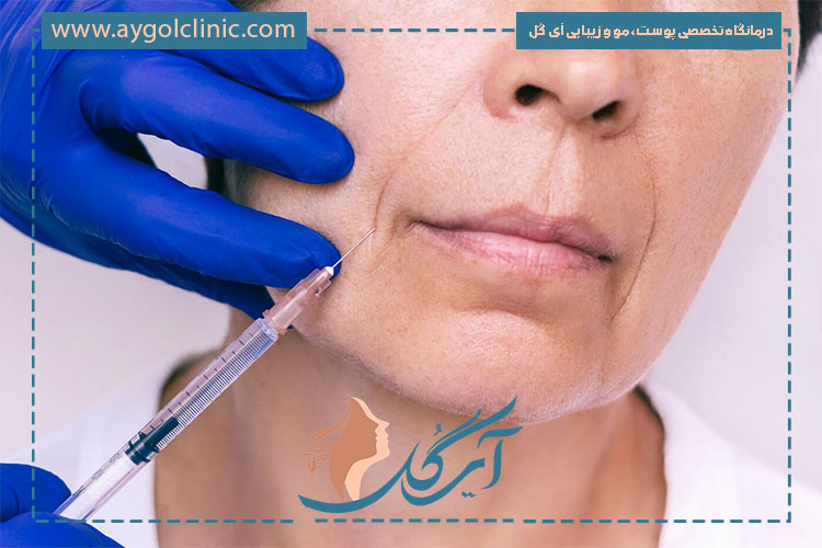 مزایای تزریق بایوفیلر برای جوانسازی طبیعی، افزایش کلاژن و بهبود کیفیت پوست
