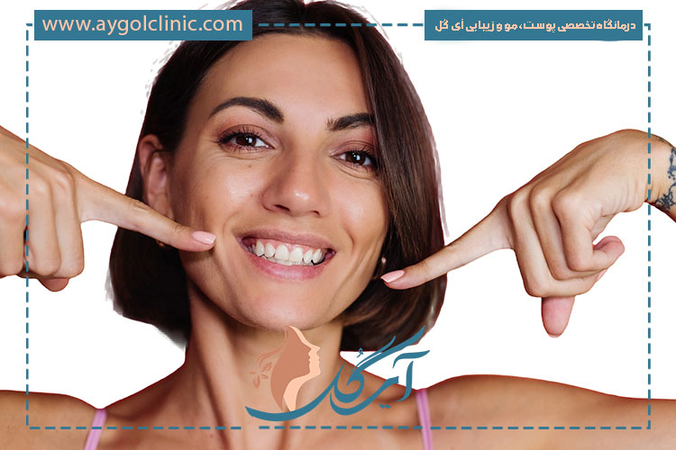 میزان ماندگاری تزریق فیلر خط خنده